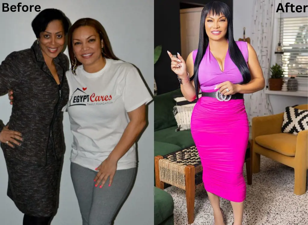 Before and  After image of Sherrod after her weight loss